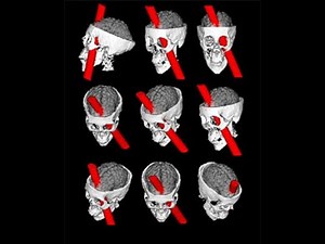 The brains of the brain: why is the prefrontal cortex involved in just about everything?