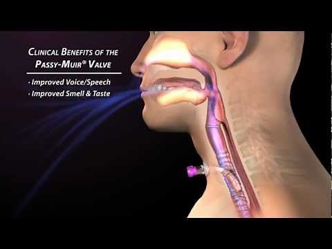Clinical Benefits of the Passy Muir Valve