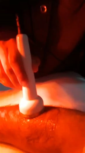 Physio Dynamics on Instagram: "Ultrasound Therapy for Tennis Elbow. #physiotherapy#medicine#posture"