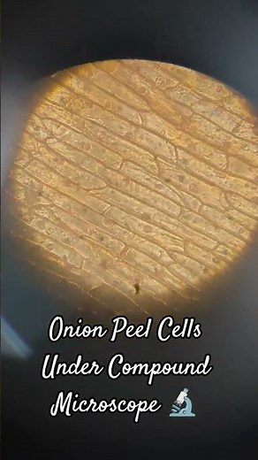 Onion Peel Cells Under Microscope 🔬 | Step-by-Step Biology Practical | Class 9 Experiment #viral