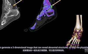 CT原理 双语中字