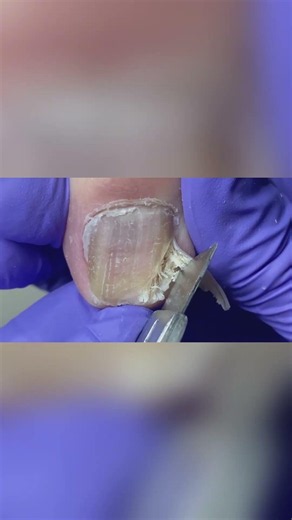 Professional pedicure step by step #pedicure #toenails #satisfying #nails