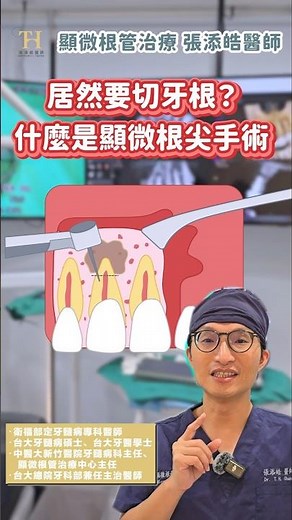 🦷牙齒根管治療後，還是不舒服、長膿包？😨或許顯微根尖手術可以幫助你✨ 什麼是顯微根尖手術？ #顯微根管治療