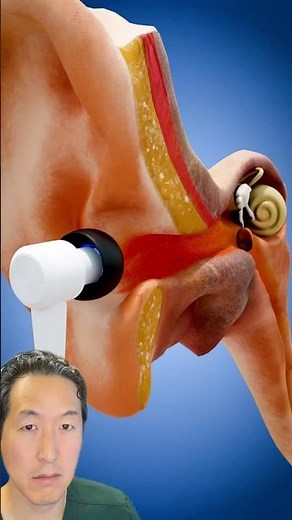 How Loud Sounds Permanently Damage Hearing… And What To Do About It!