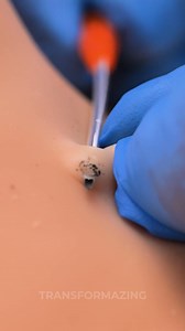 250K views · 260 reactions | Your Quick Guide to Chest Piercings! | Transformazing | Facebook