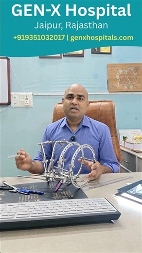 Life-Changing Limb Reconstruction with Ilizarov Technique #shortsfeed #shorts