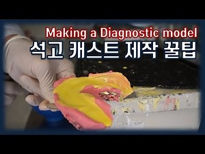 치대 실습 꿀팁] 진단모형 석고 캐스트 제작 꿀팁