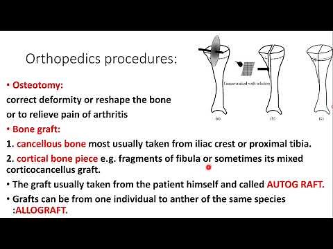 Orthopedics introduction: Definitions and healing process.