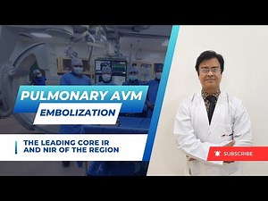 Pulmonary AVM Embolization | IRFACILITIES
