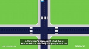33K views · 283 reactions | Learn how this interesting new approach to Alzheimer's clinical trials could help progress research. | AbbVie | Facebook