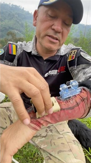 How to close a facial wound quickly #military #police #nationaldefense