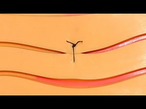 Simple Interrupted Suture in 5 Steps (with detailed explanation)