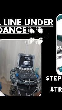 Central venous Catheter ( CVC )/USG guided Central line insertion - Internal Jugular Vein