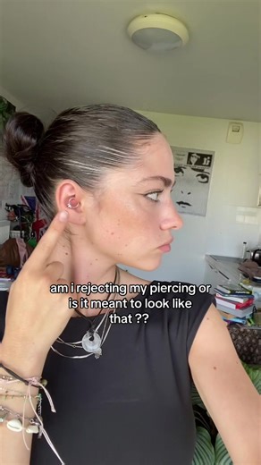 Understanding Daith Piercing Healing Issues