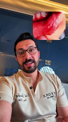 تقرحات اللثة مش دايمًا حاجة بسيطة 👀 د. محمد الشرباصي بيشرح أسباب ظهورها، إمتى تكون عادية، وإزاي تعالجها صح ✅ ولو استمرت… يبقى لازم تكشف فورًا. 01100065653 - 01019889074 📍 دمياط الجديدة - المنطقة المركزية - بجوار حلواني شريف الزيني - الدور الثاني. ‎‏#evora_dental_hub