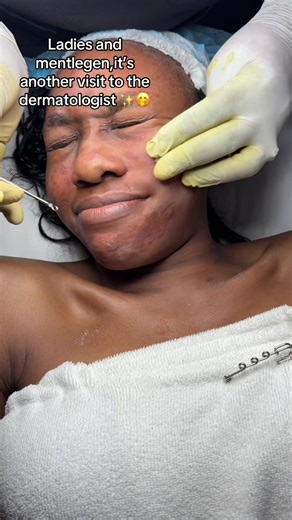 Exploring the Benefits of Chemical Face Peels with a Dermatologist