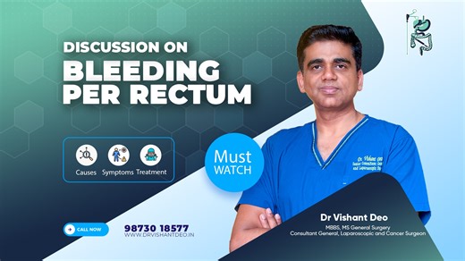 Bleeding Per Rectum — Don’t Ignore the Signs! In this awareness talk, Dr. Vishant Deo, Senior Consultant General, Laparoscopic & Cancer Surgeon, explains the causes, symptoms, and treatment options for bleeding per rectum a condition that may arise from Piles, Fissures, Infections, Polyps, or even Colorectal Cancer. Early evaluation can help detect serious conditions and prevent complications. Learn how timely consultation and modern laparoscopic treatments can help you recover faster and safer.