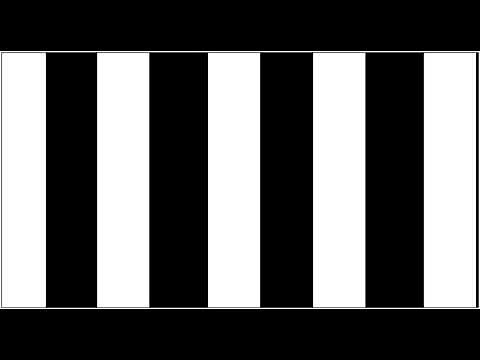 Optokinetic training | Vertical Stripes to the right