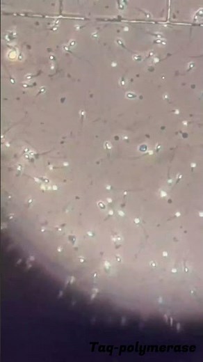 What Sperm Look Like Under the Microscope 🧬