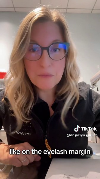 Understanding Blepharitis: Causes and Treatment for Styes