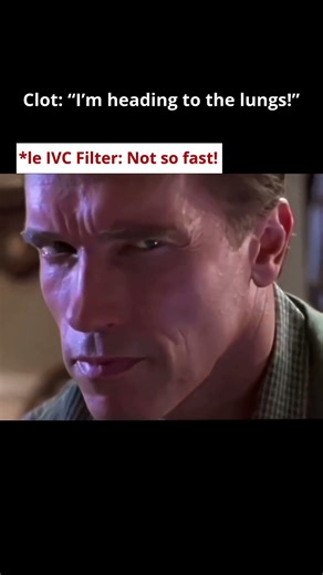 An IVC filter acts like a safety net inside the body.