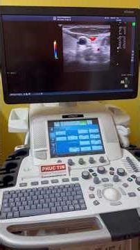 MÁY SIÊU ÂM LOGIQ E9 XDCLEAR 2.0 R6 #gehealthcare #LOGIQE9