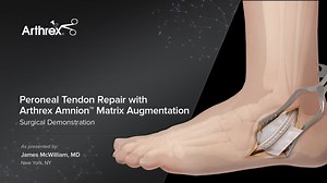 Peroneal Tendon Repair with Arthrex Amnion™ Matrix Augmentation