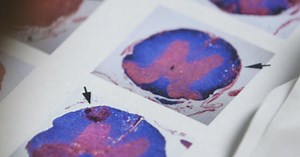 Inside the minds of altruistic organ donors