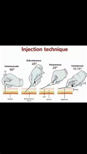 Physiôtherâpist✨ on Instagram: "Injection technique #medical #human #body #injection #limbs #viral #education #fyp #educational #trending #explore #medical #anatomy #viral ©Dr neuron3d"