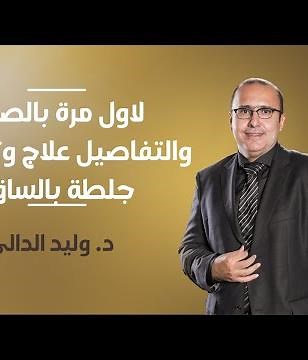جراحة لجلطة الساق: كل ما تحتاج لمعرفته للشفاء السريع!
