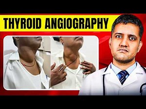 How to Cure Thyroid Goiter 100% Without Surgery | Thyroid Angiography Workshop | Dr. Gaurav Gangwani