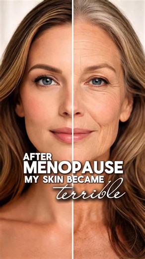 HIFU SMAS is a procedure that works not on the surface of the skin, but on its internal support structure. Ultrasound gently heats the deeper layers of tissue, making the skin firmer and more lifted. Collagen production is stimulated, and the facial contour becomes more defined. All of this happens without surgery and without long recovery time. | Massage-beauty Valery