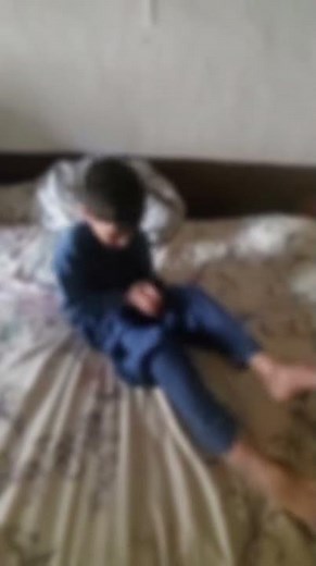 Why You Move in Your Sleep: Sleep-Related Hypermotor Epilepsy Explained!