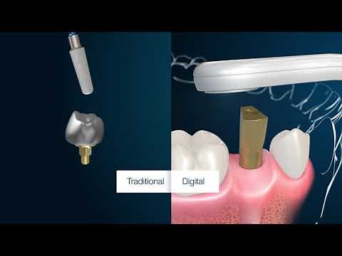 MIS CONNECT - Versatile One-Time Solution