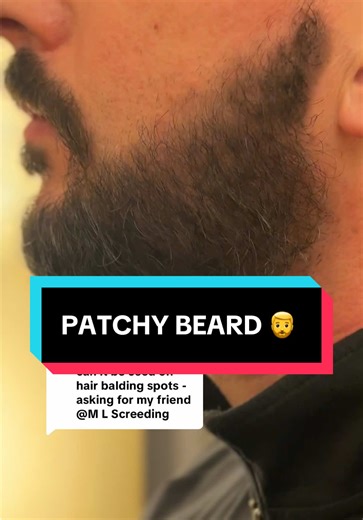 Achieve a Flawless Look with Beard Concealer