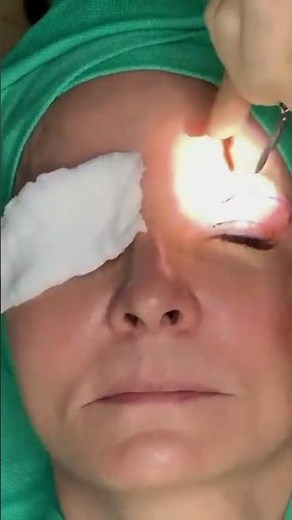 Surgical Scalpel vs. Laser: Precision Techniques