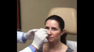 Botox for Bigger Eyes — Learn How It Works and See the Procedure