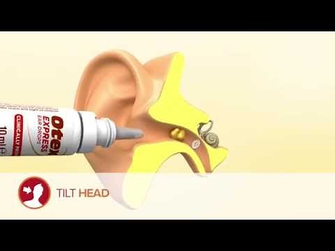 How to use Otex Express Ear Drops