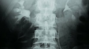 Zoom Urography Contrast Method Kidneys Human: video de stock (totalmente libre de regalías) 1031989031 | Shutterstock