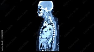 motion x-ray image of body inside by mri scanner or ct scan.