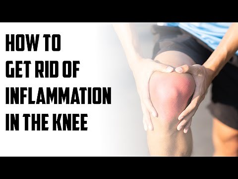How to get rid of inflammation in the knee | B Episode 131