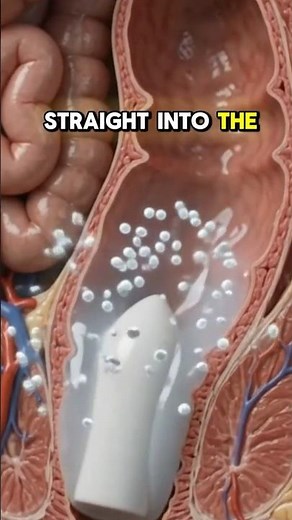 Inside YOUR body: How a suppository works #medicalanimation #medicine #pharmacy