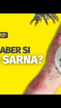 ¿Cómo saber si TENGO SARNA? 😵