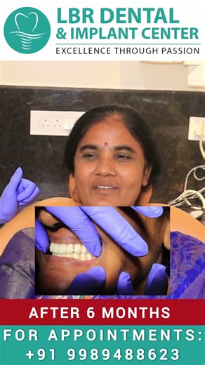 Best Dental Implants Hospital in Madapur, Hyderabad, Full Mouth Dental Implants Vizag Patient Review