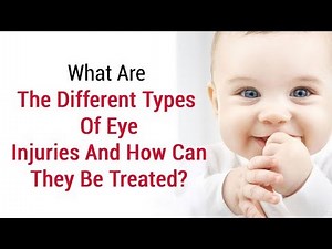 Types of eye injuries and necessary precautions | How to Treat An Eye Injury - First Aid Training