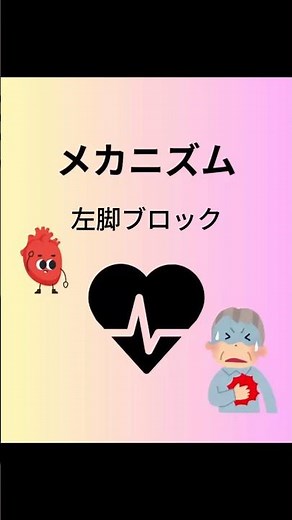 左脚ブロック（LBBB）のメカニズム｜QRS幅が広がる理由を解説！