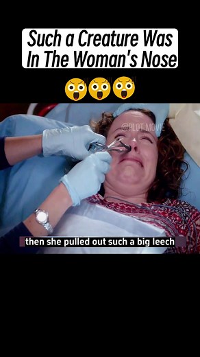 Leech in Nose Extraction Drama