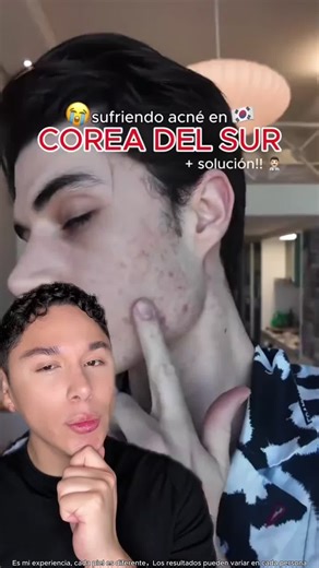 👧 ¿Tu hija adolescente tiene acné pero la piel se le pela con los tratamientos? Necesita reparar mientras trata. PAPA FEEL Crema 5X Ceramida Barrier Repair: el complemento perfecto para pieles en tratamiento. 🤝🧴 No comedogénica, textura ligera, cero grasa. 5X Ceramidas reconstruyen lo que el ácido salicílico o el peróxido de benzoilo dañan. Porque curar el acné no debería doler tanto. 🩹✨ #papafeel #papafeelmx #moisturizer #skincare #glowing #Ceramidas #VentaQuincenal keyword✨：PAPA FEEL Crema