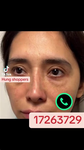 This is a West&Month Propolis Wrinkle Eye Cream. Key Ingredients: Formulated with propolis extract and sea buckthorn. Benefits: Helps reduce eye skin problems such as dark circles, puffiness, fine lines, wrinkles, and crow's feet. Skin Type: Suitable for daily use by both men and women and for all skin types. Application: Apply a small amount around the eyes and tap lightly until absorbed. #creatorsearchinsights #fyppppppppppppppppppppppp #fypシ゚viral🖤tiktok #foryoupage❤️❤️ #fypviralシviral🖤tikt