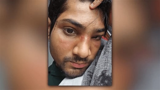 Student attacked on CTA says conductor told him to move cars after witness pressed help button